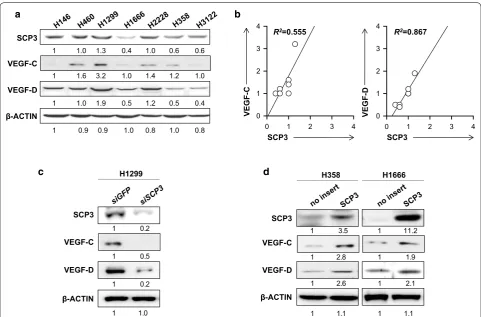 Fig. 1 Correlation between SCP3 and VEGF‑C or VEGF‑D expressions in human lung cancer cells