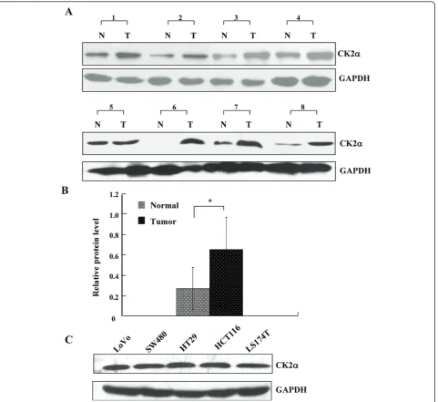 Figure 2 CK2a protein expression in CRC tissues and cell lines. (A) Western blot analysis of CK2a expression in eight pairs of CRC tissuesand adjacent, normal colorectal mucosa tissues