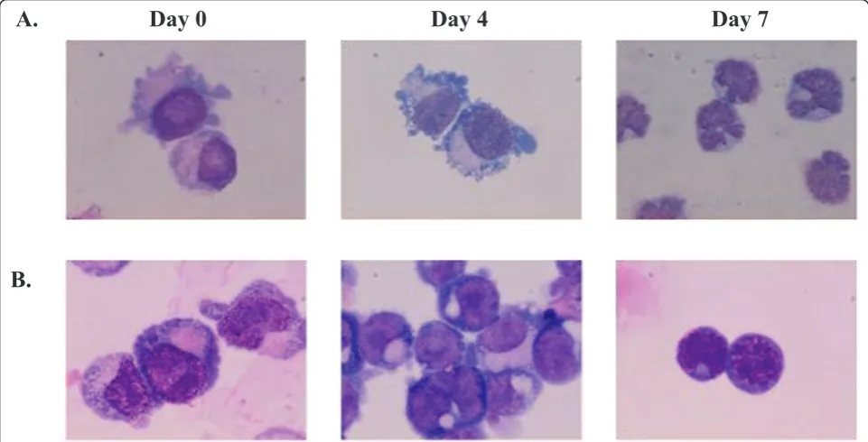 Figure 2 Cultures of HSC/CD34developed to erythroblasts and showed characteristic cell morphology of cells undergoing apoptosis including cell membrane blebbing and+ from HbE/b-thalassemic patients (A) and normal donors (B)