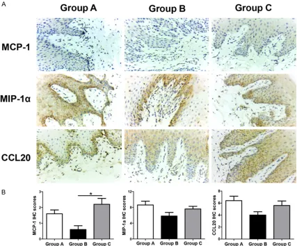 Figure 3. Expression of chemotactic factors MCP-1, MIP-1α and CCL20 in the oral gingival tissues of rhesus ma-caques determined by immunohistochemistry (Original magnification, × 400)