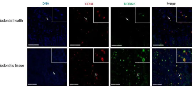 Figure 2.3. Identification of MORN2 in human gingival tissues. (A) The mRNA relative level of MORN2  was determined in gingival tissues from healthy (n=26) and chronic periodontitis (n=19) subjects by  real-time PCR
