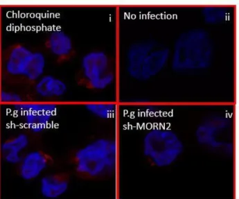 Figure 2.4. MORN2 is required for LAP. (A, B) THP-1 cells derived macrophages with shMORN2 or  scrambled control shRNA were infected with P.g (MOI=100) and then bacterial uptake (A) and bacterial  viability (B were evaluated by CFU counting