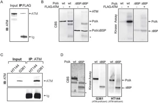 Figure 1. Phosphorylation of human Polλ by ATM-enriched immunoprecipitates in vitro.