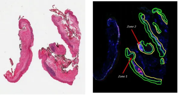 Figure 2.  Example of annotations made on IF/IHC slides. 