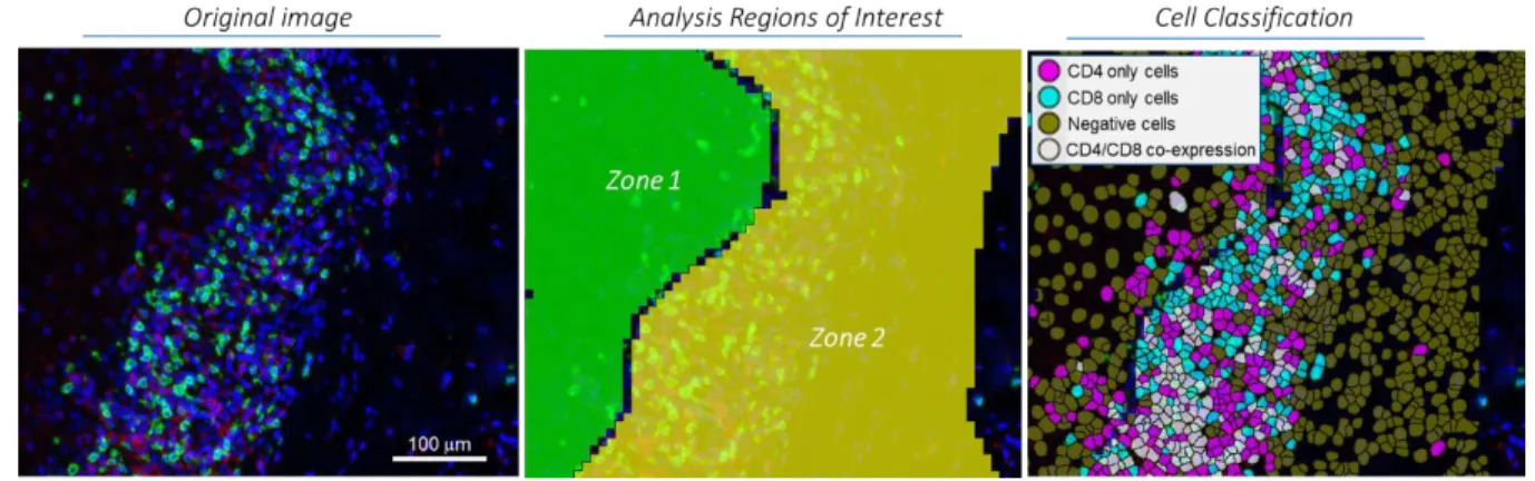 Figure 3.  Graphic representation of the region analysis and cells classification made by the software (Zone 1: 