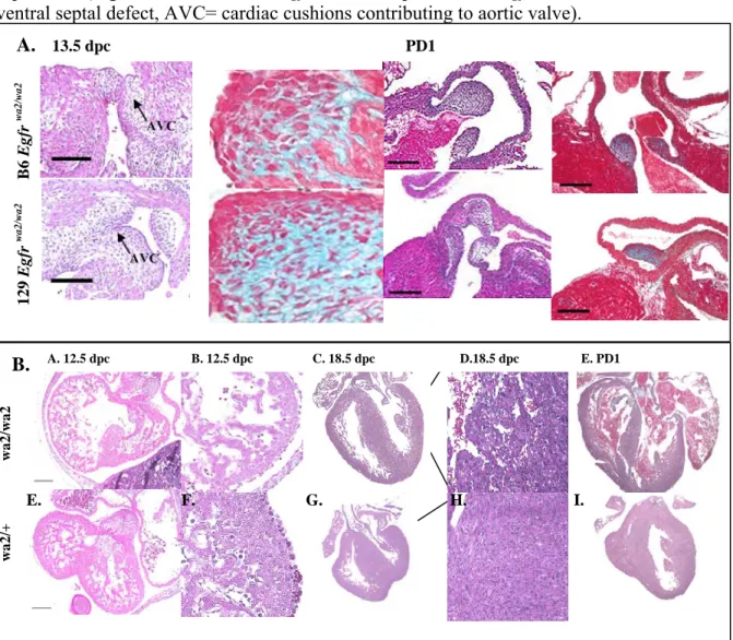 Figure 3-3. Comparison of congenital cardiac defects in B6 and 129 Egfr  wa2  embryos