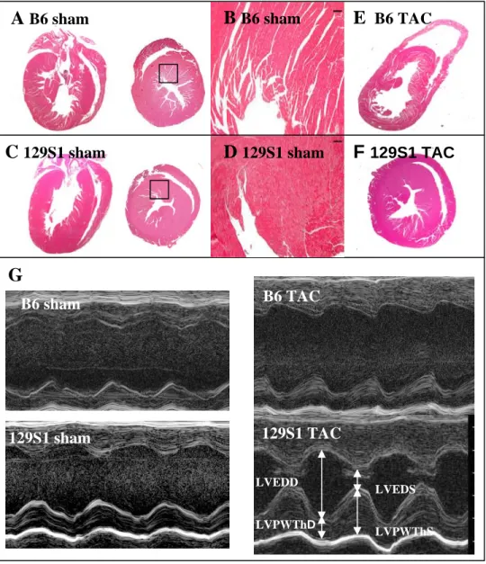 Figure 2-1. B6 and 129S1 male mice have innate differences in cardiac morphology.  (A-F)  Representative H&amp;E staining of cardiac sections from B6 and 129S1 sham (A-C) and TAC  (E and F) heart five weeks post-surgery (A,C, E and F, magnification, 1.6x; 