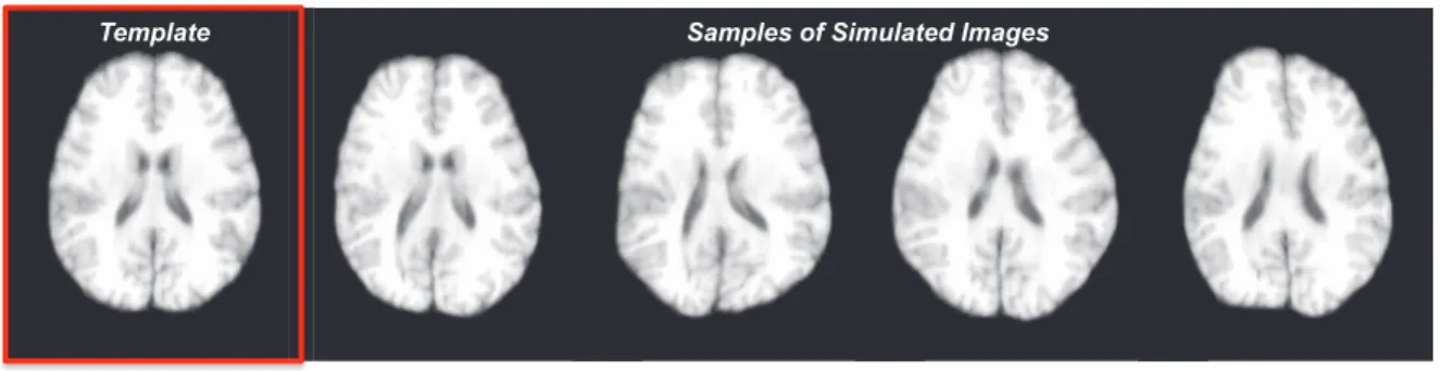 Figure 2.6: The template and samples of simulated images for the evaluation in Section 2.3.6.