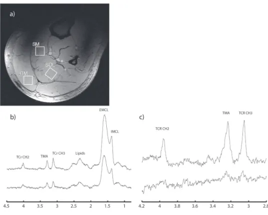 Figure 3: Anatomic image and acquired MR spectra.