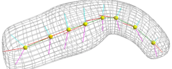 Figure 4.4: A mean model of a rectum from one of our studies showing the medially  im-plied surface as a wireframe.