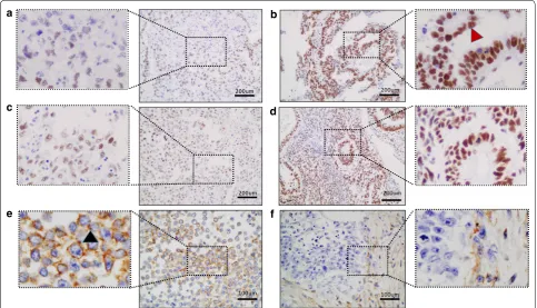 Fig. 1 Representative immunohistochemistry images of hMLH1, hMSH‑2 and EGFR protein expression