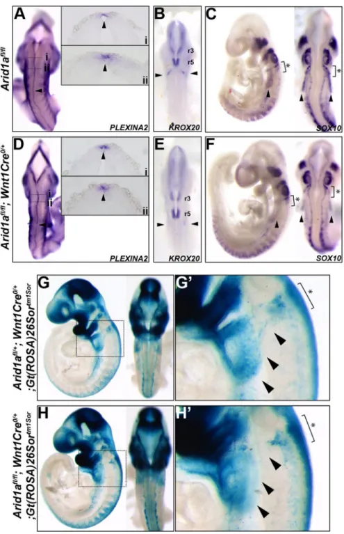 Figure 4. ARID1A loss in NCCs affects early cardiac NCC migration