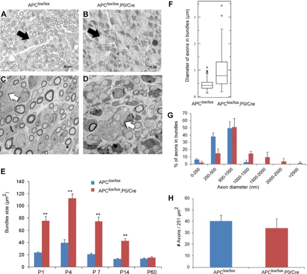Fig. 3. APC loss disrupts the radial axonal sorting process in the PNS. The sciatic nerves of Apc lox/lox ;P0-Cre and control Apc lox/lox mice were analyzed morphometrically on Toluidine Blue-stained semi-thin sections (A,B) and by EM (C,D)