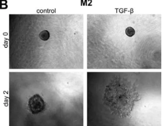 Figure 3 TGF‐β‐induced invasion of spheroids of  spontaneously immortalised MCF10A1 (M1)  (A),  RAS‐transformed MCF10AneoT (M2 (B) and its metasta c deriva ve MCF10CA1a (M4) (C). 