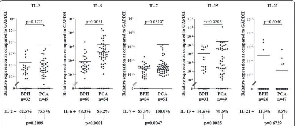 Figure 1 Expression of IL genes in early stage PCA and BPH tissuestreated, reverse transcribed and analyzed by quantitative real-time PCR for IL-2 (BPH: n = 32, PCA: n = 49), IL-7 (BPH: n = 34, PCA: n = 51), IL-15(BPH: n = 31, PCA: n = 49), IL-6 (BPH: n = 