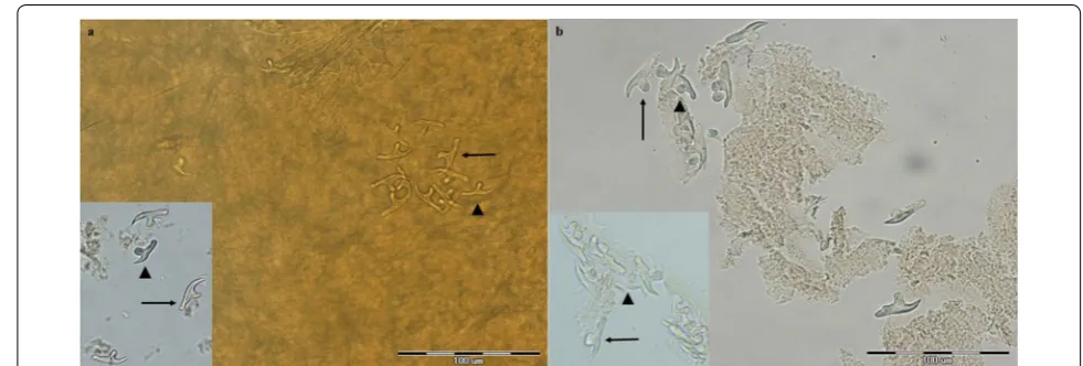 Fig. 4 Photomicrographs of the scolex of Echinococcus multilocularis (a) and Echinococcus granulosus (b)