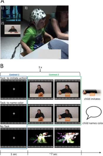 Figure 1.  Panel A shows a still frame from the video recording of a 4-year-old child during the EEG recording