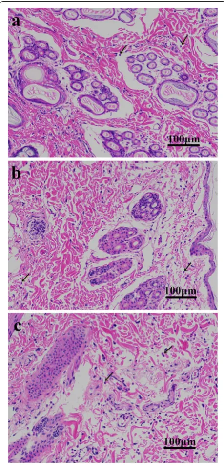 Fig. 2 Hematoxylin and eosin (H&E) staining. a H&E staining of skin injected with recombinant Der p 1‑like protein