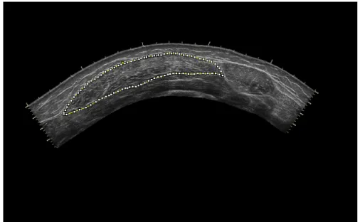 Figure 3.10. CSA of vastus lateralis panoramic ultrasound image.  