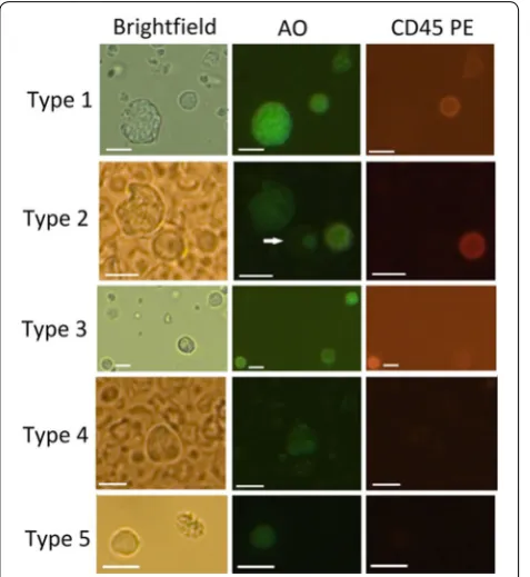 Fig. 6 Images of CD45negative cells. Representative images of cells from different donors shown under brightfield, fluorescence green light and fluorescence red light