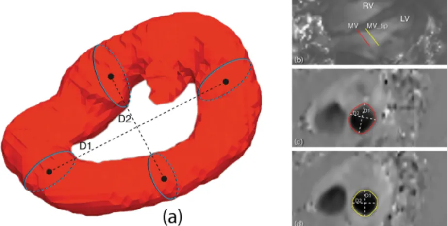 Figure 2.2. Diagram showing the measurement of the vortex circularity Index (CI). In (a),  CI=D2/D1, D1 represents vortex’s long diameter and D2 represents the vortex’s shortest  diameter