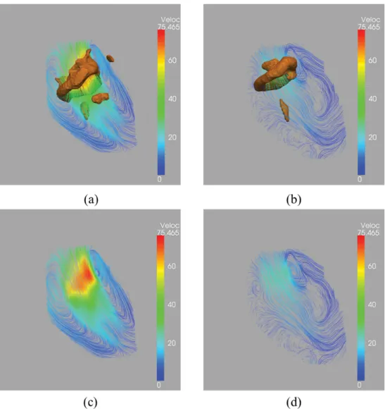 Figure 2.5. Streamline superimposed on vortex cores. Sample Streamline visualization of  cross-sectional view of LV flow during peak early filling (a) peak late filling (b) showing  pair of counter-rotating vortices