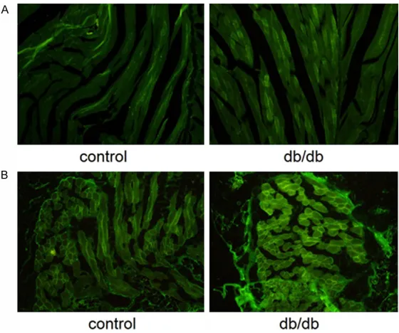 Figure 2. SPARC mRNA expression in skeletal muscle (A) and adipose tissue (B). Total RNA was extracted, and mRNA expression was evaluated using RT-PCR, with β-actin as the control