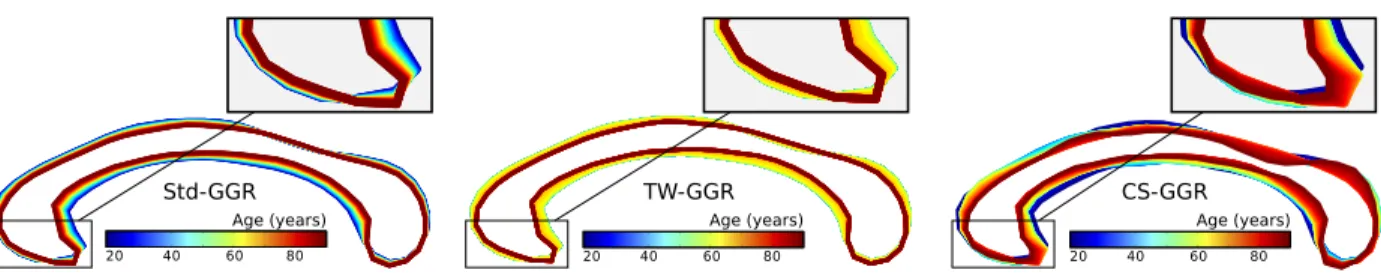 Figure 3.7: Comparison between Std-GGR, TW-GGR and CS-GGR (with one control point) on the corpus callosum data [Fletcher, 2013]