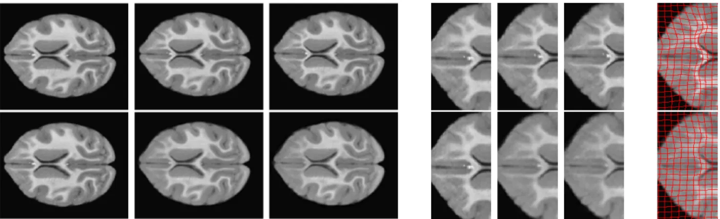 Figure 3.15: Regression results for monkey data: LDDMM (top) metamorphosis (bottom). (a) Images on geodesic at 12, 6, 3 months; (b) Zoom in for images on geodesic at 12, 6, 3 months; (c) Zoom in for images at 3 months to illustrate spatial deformation.