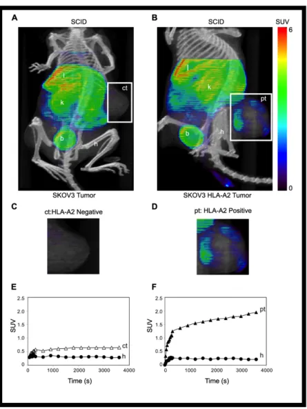 Figure 5. TCR-like Fab binds specifically to human tumor cells in SCID mice.  