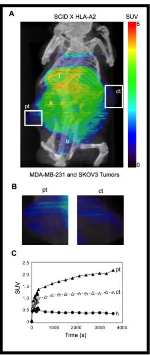 Figure 6. TCR-like Fab binds specifically to human tumor cells in HLA-A2  transgenic SCID mice