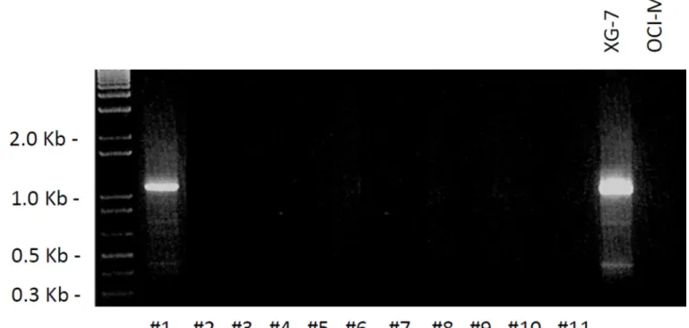 Figure 1. RT-PCR assay for the detection of the IgH-MMSET hybrid transcript, associated with  the t(4;14) translocation, in CD138+ primary tumor cells