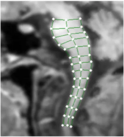 Figure 2.3. 2D discrete m–rep used for segmentation of the brainstem [42].