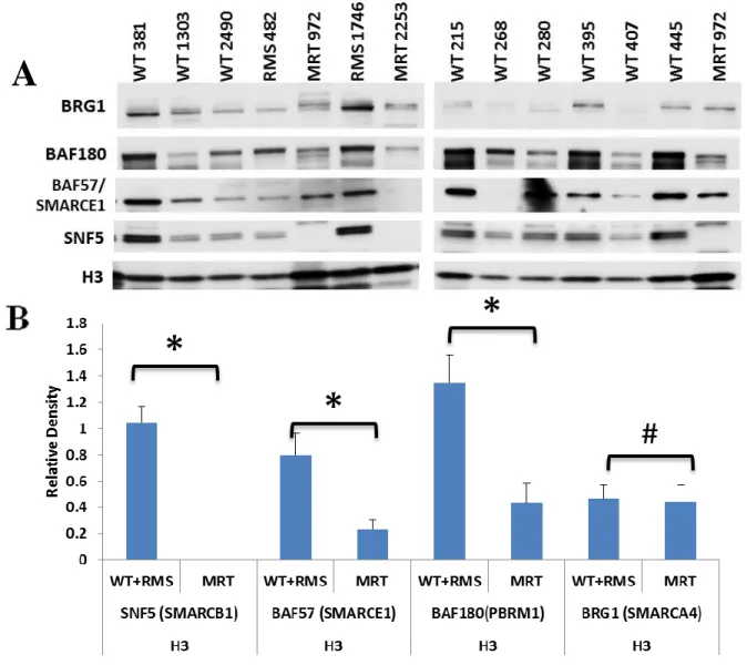 Figure 2.2 – Decreased SWI/SNF complex proteins in primary tumor samples. (A)  Nuclear protein (3 μg) isolated from primary tumors were separated on a 4 to 12% Bis-Tris  polyacrylamide gel, transferred to PVDF membranes and probed with BRG1,  anti-BAF57, a