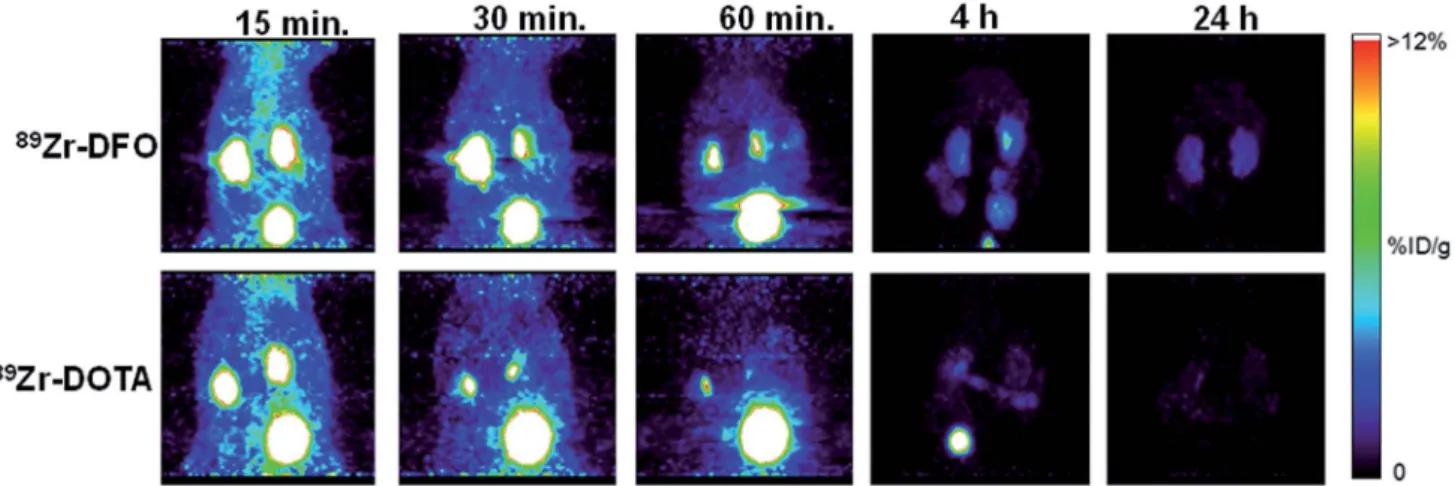 Fig. 3 PET maximum-intensity projection images comparing 89 Zr –DOTA and 89 Zr –DFO. 89 Zr –DOTA undergoes more eﬃcient renal excretion than 89 Zr –DFO