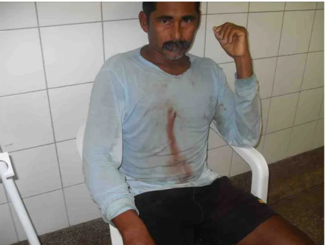 Figure	  2:	  Shooting	  victim,	  Renascer	  January	  2010	  