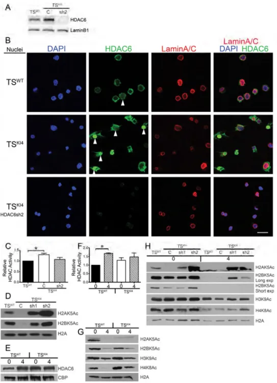 Figure 5. TS KI4  cells have increased nuclear HDAC6 localization and function