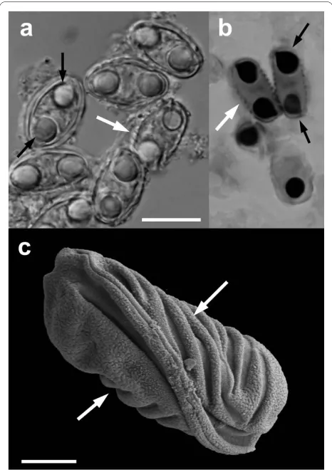 Figure 2 Myxidium Limnodynastes peroniicf. immersum spores recovered from the Aus-tralian Museum