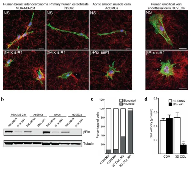 Figure 11:  Conservation  of  the  βPix  pathway  in  controlling  migration  in  fibrillar  collagen environments a  Single  siRNA  knockdown  of  βPix  in  human  breast  adenocarcinoma cells, primary human osteoblasts, human aortic smooth muscle cells, 