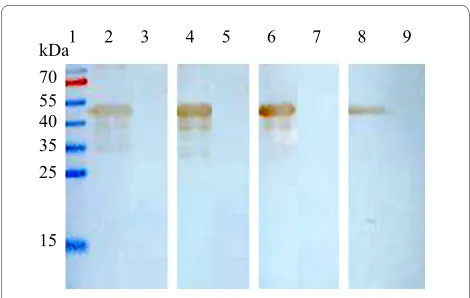 Figure 1 Reactivity of S12 σB MAbs to and pET30a vector3, 5, 7, and 9 4 and 5 MAb 4E3; lane 6 and 7 MAb 2F7; lane 8 and 9 MAb 5D8, respec-E coli expressed pET30-σB 