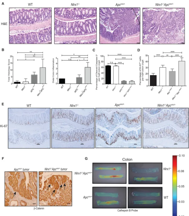 Figure 4. Nlrx1 Deficiency on the Apc min/+  Background Leads to Increased Proliferation and  Greater Expression of the Tumor Biomarkers β-Catenin and Cathepsin B