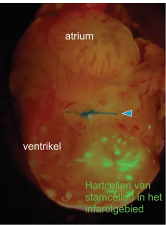 Fig 2: Muis hart 6 maanden na een hartinfarct en injectie van hartcellen afkomstig van humane embryonale stamcellen (groen gekleurd) in het ventrikel