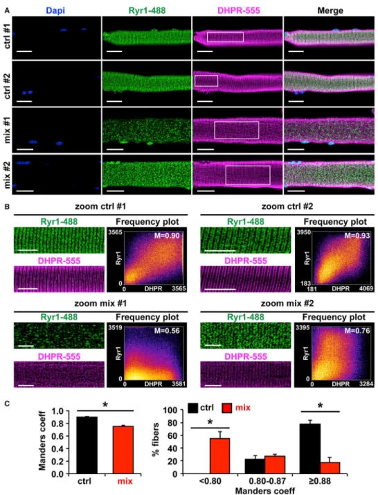 Figure 4. Ryr 1 and DHPR Are Mislocalized after AS Redirection