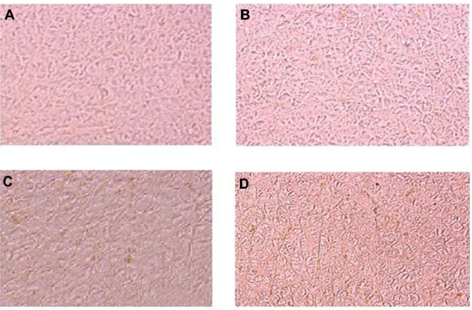 Figure 3 Lightrats 48 hours post-exposure to titanium oxide nanoparticles (252 mg per animal) by intraperitoneal administration demonstrating swelling of hepatocytes (arrows) and presence of nanoparticle beneath the capsule (*)