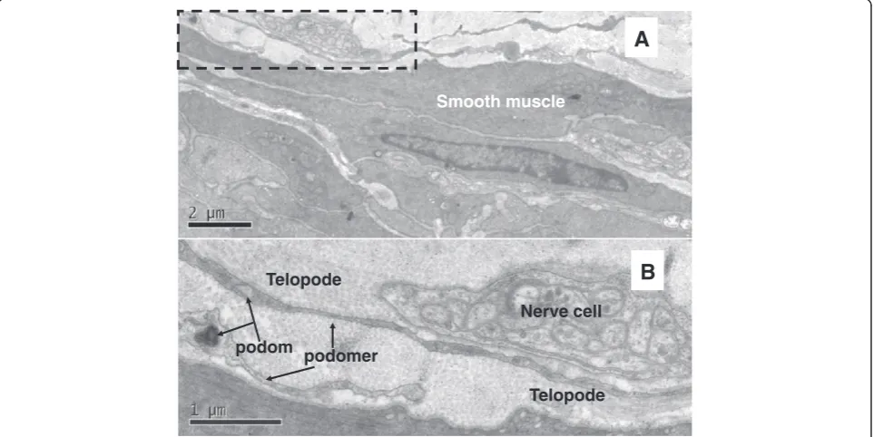 Figure 2 TEM of rat ureter. Telocyte and telopode exist in laminapropria of ureter, and they connect with capillaries and smoothmuscles