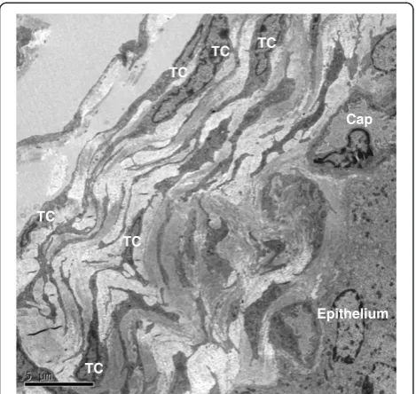 Figure 4 TEM of rat ureter. Atelocytes. shows typical telopodes (Tp) and telocytes (TC) in the ureter, and telocytes connect with telopodes from other B is the enlargement of white dotted frame in A, and the details about the connection between telcoytes (