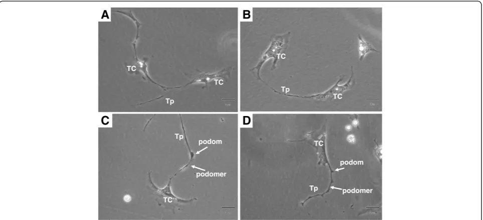 Figure 6 Telocytes from rat sub-capsular space of kidney. Primary culture, 5 days. There are two telocytes with typical Tp in A/B, and theyconnect together