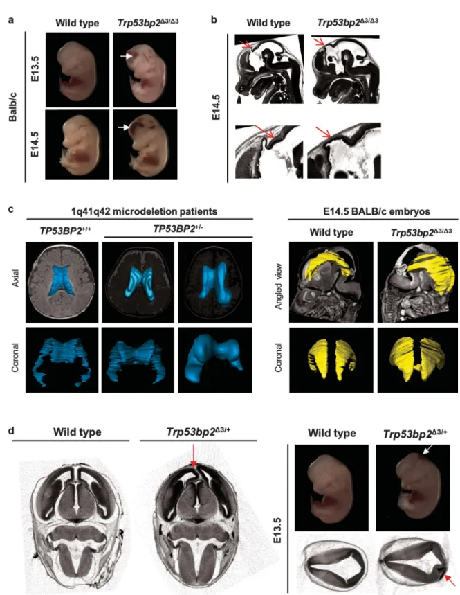 Figure 3 Trp53bp2 Δ3/Δ3 and Trp53bp2 Δ3/+ mice have CNS defects. (a) Gross dilation of lateral ventricles is visible in Trp53bp2 Δ3/Δ3 embryos, resulting in bulging foreheads.