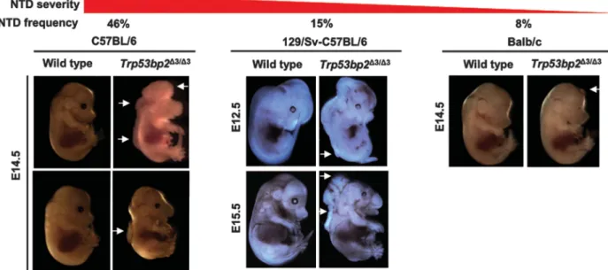 Figure 4 Trp53bp2 Δ3/Δ3 mice have neural tube defects. Strain dependence of NTD penetrance in Trp53bp2 Δ3/Δ3 mice: Embryo phenotypes in pure C57BL/6 (left), mixed 129 Sv-C57BL/6 (middle), and BALB/c (right) background embryos range in severity from small e