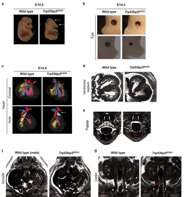 Figure 5 ASPP2-deficient mice have non-CNS phenotypes. (a) Craniofacial abnormalities in Trp53bp2 Δ3/Δ3 E14.5 embryos include dolichocephaly and hypoplasia or agenesis of the lower jaw (white arrows)